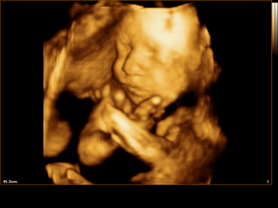 3/4d ultrazvukový obrázek